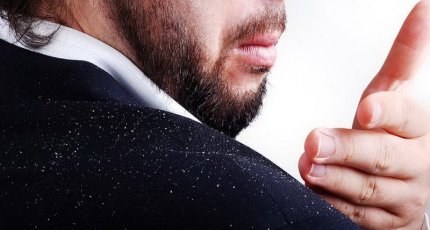 Лечебные средства от перхоти, которые можно приобрести в аптеках