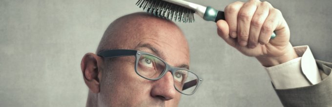 Основные причины и лечение облысения у мужчин